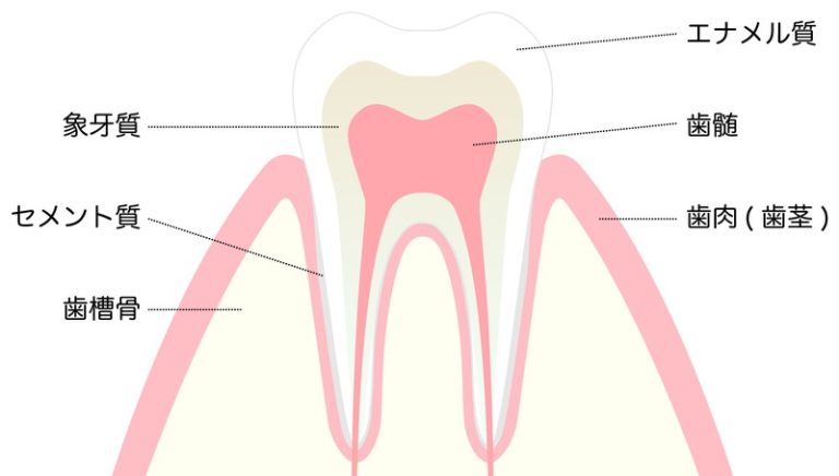歯の内部の黄ばみ
